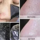10Pcs Deep Cleaning Nose Pore Strips For Blackhead Removal Blackhead Remover GOF