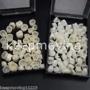 2 Packs Dental Temporary Crown Material for Anterior + Molar Teeth Veneers