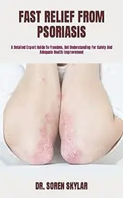 FAST RELIEF FROM PSORIASIS: A Detailed Expert Guide To Freedom, Get Understanding For Safety And Adequate Health Improvement