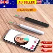 Wireless HD Ear Wax Remover Camera Ear Endoscope Spoon Pick Ear Cleaning Tool NJ