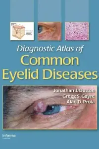 在飛比找博客來優惠-Diagnostic Atlas of Common Eye
