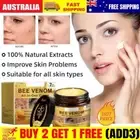 Bee-Venom Skin-Treatments Cream Natural Herbal Effective Skin-Tag Removal Cream