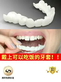 在飛比找樂天市場購物網優惠-日本進口仿真假牙套牙老人沒牙吃飯神器男女缺牙斷牙臨時美白牙套