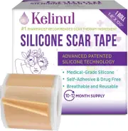 Hojas De Silicona Para Cicatrices (Rollo De 1,6 X 120 Pulgadas) Cinta De Sil...