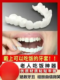 在飛比找樂天市場購物網優惠-日本進口仿真牙套吃飯神器老人男女防塞牙缺牙美白假牙套牙縫大