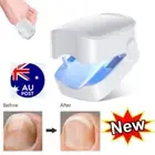 Nail Fungus Laser Device Light Therapy Onychomycosis Toes Treatment Home 910nm