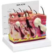 Acne Skin GPI Anatomical Model LFA #3751. Make Us an Offer! SEE VIDEO