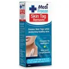 MEDI FREEZE SKIN TAG REMOVER 38ml NEW
