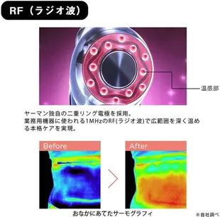 YA-MAN【日本代購】雅萌 家庭用超聲波按摩儀 HRF-18