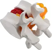 POPETPOP Lumbar Disc Herniation Model Human Anatomical Lumbar Model for School Student Learning Teaching Human Lumbar Spine Vertebrae Degenerative Model