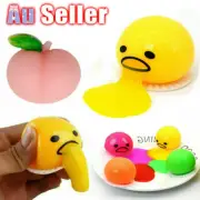 Squishy Puking Egg Yolk Squeeze Ball With Yellow Goop Anti-Stress Relief Toy NEW