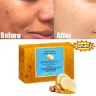 Lemon Turmeric Kojic Acid Soap Bar, Turmeric Face and Body Soap