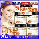 Bee Venom Cream Smooth Skin Remover Spot Repair Wart Treatment Tag Removal Body