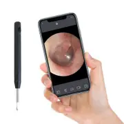 Smart Ear Wax Cleaner Removal Wireless Visual Endoscope Ear Wax Pick 6 LED Light