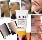 Acne, Pimples, Psoriasis, Natural Gel with Tea Tree Oil - SKLEER Gel