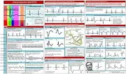 ECG Pocket Guide | ECG Rhythm Interpretation Badge Card | ECG Interpretation Pocket Card - Horizontal and Vertical Layout, Compact Reference Manual for Nursing in Hospitals