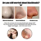 60pcs Pore Strip Blackhead Removal Mighty Deep Cleansing Nose Patch For Skin EOM