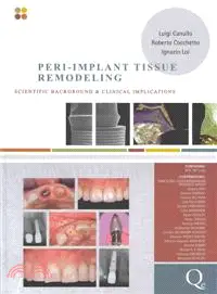 在飛比找三民網路書店優惠-Peri-Implant Tissue Remodeling