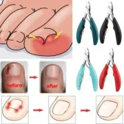 Paronychia Clippers Toenail Cutter Ingrown Nipper Cuticle Scissors Pedicure UK