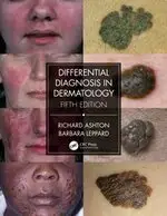 DIFFERENTIAL DIAGNOSIS IN DERMATOLOGY 5/E ASHTON ROUTLEDGE