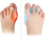 Ajustable 3 Holes Overlapped Toes Corrector for Adolscent