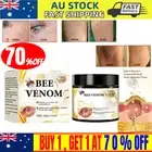 Bee Venom Skin Tag Removal Treatment Cream - Body Care Mole Corn Skins Wart