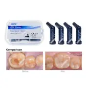 Dental Compules Unidose Composite Resin Capsules Light Cure Fit TPH Kerr A1/2/3