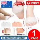 Silicone Toe Separator Gel Bunion Corrector Spreader Pain Relief Unisex Hallux