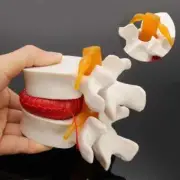 Human Anatomy Skeleton Spine Lumbar Disc Herniation Teaching Model Brain Skull