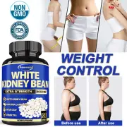 White Kidney Bean - Weight Loss, Carb Blockers - Garcinia Cambogia, Green Tea