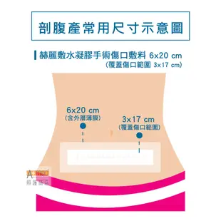 赫麗敷 HERADERM-水凝膠手術傷口敷料 6x20cm 5片入 (剖腹產專用) /型號 HD-PS24 現貨