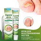Nail Fungus Fungal Removal Cream Treatment Care Onychomycosis Infection US