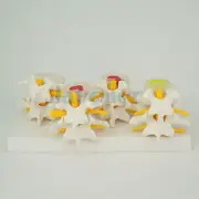 Anatomical Human Lumbar Vertebrae Degenerative Disc Disease Model Medical