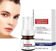 Aobenz and Freckle Removing Essence, Aobenz Dark Spot Remover for Face, Whitening Cream for Face, Whitening Moisturizing Serum, Dark Spot Correcting Serum for Women, Wrinkle Remover Skin (1pcs)