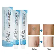 Vein Repair Cream - Improve Blood Circulation and Reduce Varicose Veins 2pcs