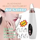 Electric Blackhead Remover Facial Skin Pore Cleaner Face Vacuum Derma Suction AN