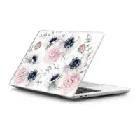 在飛比找CASETiFY優惠-MacBook Pro 13" (2020 / 2022) 