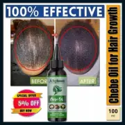 Chebe Hair Oil – Fast Hair Growth & Breakage Protection | 100% Natural FS