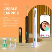 Wireless Ear Wax Remover Camera HD Ear Endoscope Spoon Pick Cleaning Tools DS