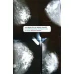 THE BIOPOLITICS OF BREAST CANCER