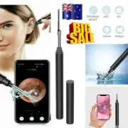 1080P Ear Wax Remover Camera Wireless Ear Endoscope Spoon Cleaning Otoscope QT