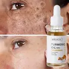 Turmeric Freckle Whitening Serum Curcumin Oil Face Brighten Fade Dark Spot Remov