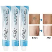 Vein Repair Cream - Improve Blood Circulation and Reduce Varicose Veins 3pcs