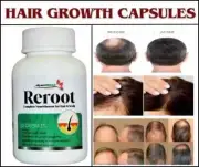 Hair Growth Vitamins For Men - Anti Hair Loss Pills. Regrow Hair & Beard.60caps