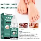 Anti Fungal Nail Treatment fungu Nail Finger Toe Fungus ne Onychomycosis P2T3