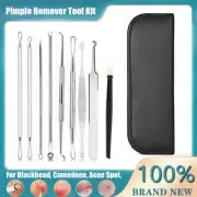 10 Pcs Blackhead Acne Spot Comedone Pimple Blemish Extractor Remover Tool Kit