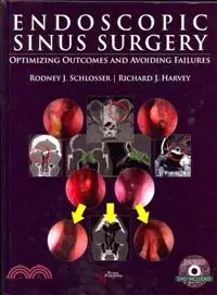 在飛比找三民網路書店優惠-Endoscopic Sinus Surgery