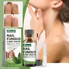 Nail Treatment Fungus Anti Fungal Toe Removal Care Infection Liquid Solutio U4E9