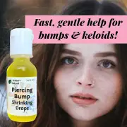 Urban ReLeaf Piercing Bump Shrinking Drops! Aftercare Keloid Scar Cartilage Red