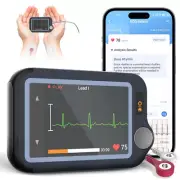 Touch Screen EKG Monitor Heart Monitor with ECG Cable AI-ECG Analysis via App